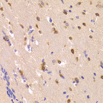ROCK2 Antibody - Immunohistochemistry of paraffin-embedded mouse brain tissue.