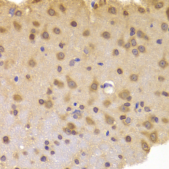 ROCK2 Antibody - Immunohistochemistry of paraffin-embedded rat brain tissue.
