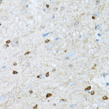 ROCK2 Antibody - Immunohistochemistry of paraffin-embedded mouse spinal cord tissue.