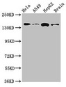 ROCK2 Antibody - Western Blot Positive WB detected in:Hela whole cell lysate,A549 whole cell lysate,HepG2 whole cell lysate,Mouse brain tissue All Lanes:ROCK2 antibody at 2.7µg/ml Secondary Goat polyclonal to rabbit IgG at 1/50000 dilution Predicted band size: 161 KDa Observed band size: 161 KDa