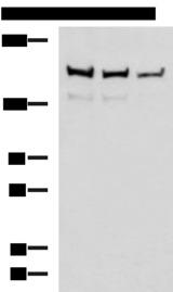 ROCK2 Antibody - Western blot analysis of Mouse brain tissue Rat brain tissue and HepG2 cell lysates  using ROCK2 Polyclonal Antibody at dilution of 1:400