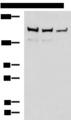 ROCK2 Antibody - Western blot analysis of Mouse brain tissue Rat brain tissue and HepG2 cell lysates  using ROCK2 Polyclonal Antibody at dilution of 1:400