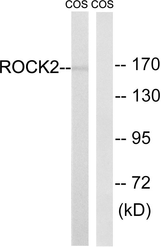 ROCK2 Antibody - Western blot analysis of extracts from Cos7 cells, using ROCK2 (Ab-722) antibody.