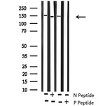ROCK2 Antibody - Western blot analysis of Phospho-ROCK2 (Tyr722) antibody expression in rat brain and mouse lung tissues lysates.