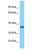 ROGDI Antibody - ROGDI antibody Western Blot of ACHN. Antibody dilution: 1 ug/ml.  This image was taken for the unconjugated form of this product. Other forms have not been tested.