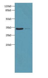 ROGDI Antibody - Western blot. All lanes: ROGDI antibody at 1.2 ug/ml. Lane 1: HeLa whole cell lysate. Lane 2: K562 whole cell lysate. Secondary Goat polyclonal to Rabbit IgG at 1:10000 dilution. Predicted band size: 32 kDa. Observed band size: 32 kDa.