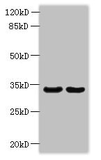 ROGDI Antibody - Western blot All lanes: ROGDI antibody at 1.2µg/ml Lane 1: Hela whole cell lysate Lane 2: K562 whole cell lysate Secondary Goat polyclonal to rabbit IgG at 1/10000 dilution Predicted band size: 33 kDa Observed band size: 33 kDa