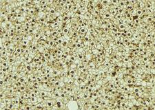 ROGDI Antibody - 1:100 staining mouse liver tissue by IHC-P. The sample was formaldehyde fixed and a heat mediated antigen retrieval step in citrate buffer was performed. The sample was then blocked and incubated with the antibody for 1.5 hours at 22°C. An HRP conjugated goat anti-rabbit antibody was used as the secondary.