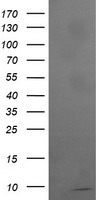 ROMO1 Antibody - HEK293T cells were transfected with the pCMV6-ENTRY control (Left lane) or pCMV6-ENTRY ROMO1 (Right lane) cDNA for 48 hrs and lysed. Equivalent amounts of cell lysates (5 ug per lane) were separated by SDS-PAGE and immunoblotted with anti-ROMO1.