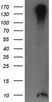 ROMO1 Antibody - HEK293T cells were transfected with the pCMV6-ENTRY control (Left lane) or pCMV6-ENTRY ROMO1 (Right lane) cDNA for 48 hrs and lysed. Equivalent amounts of cell lysates (5 ug per lane) were separated by SDS-PAGE and immunoblotted with anti-ROMO1.