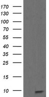 ROMO1 Antibody - HEK293T cells were transfected with the pCMV6-ENTRY control (Left lane) or pCMV6-ENTRY ROMO1 (Right lane) cDNA for 48 hrs and lysed. Equivalent amounts of cell lysates (5 ug per lane) were separated by SDS-PAGE and immunoblotted with anti-ROMO1.