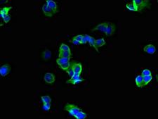 ROMO1 Antibody - Immunofluorescent analysis of MCF-7 cells using ROMO1 Antibody at dilution of 1:100 and Alexa Fluor 488-congugated AffiniPure Goat Anti-Rabbit IgG(H+L)