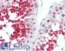 ROPN1L Antibody - Anti-ROPN1L antibody IHC staining of human testis. Immunohistochemistry of formalin-fixed, paraffin-embedded tissue after heat-induced antigen retrieval. Antibody concentration 5 ug/ml.  This image was taken for the unconjugated form of this product. Other forms have not been tested.