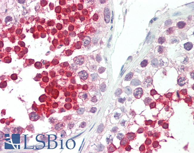 ROPN1L Antibody - Anti-ROPN1L antibody IHC staining of human testis. Immunohistochemistry of formalin-fixed, paraffin-embedded tissue after heat-induced antigen retrieval. Antibody concentration 5 ug/ml.  This image was taken for the unconjugated form of this product. Other forms have not been tested.