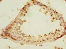 ROPN1L Antibody - Immunohistochemistry of paraffin-embedded human testis tissue using antibody at dilution of 1:100.