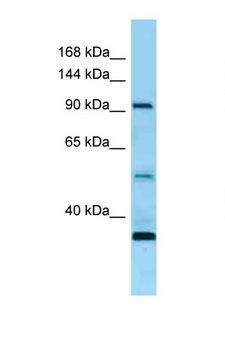 ROR1 Antibody - ROR1 antibody Western blot of Fetal Heart lysate. Antibody concentration 1 ug/ml.  This image was taken for the unconjugated form of this product. Other forms have not been tested.