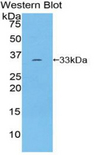ROR1 Antibody - Western blot of recombinant ROR1.  This image was taken for the unconjugated form of this product. Other forms have not been tested.
