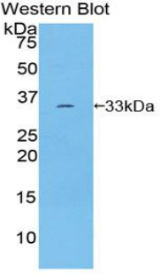 ROR1 Antibody - Western blot of recombinant ROR1.  This image was taken for the unconjugated form of this product. Other forms have not been tested.