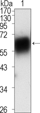 ROR1 Antibody - Western blot using ROR1 mouse monoclonal antibody against extracellular domain of human ROR1 (aa30-423).