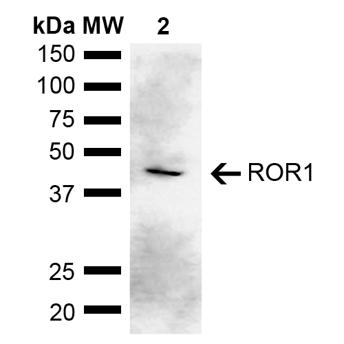 ROR1 Antibody - Western blot analysis of Rat Kidney showing detection of ~43 kDa ROR1 protein using Rabbit Anti-ROR1 Polyclonal Antibody. Lane 1: Molecular Weight Ladder (MW). Lane 2: Rat Kidney. Load: 15 µg. Block: 5% Skim Milk in 1X TBST. Primary Antibody: Rabbit Anti-ROR1 Polyclonal Antibody  at 1:1000 for 2 hours at RT. Secondary Antibody: Goat Anti-Rabbit IgG: HRP at 1:4000 for 1 hour at RT. Color Development: ECL solution for 5 min at RT. Predicted/Observed Size: ~43 kDa. Other Band(s): Isoform 3.