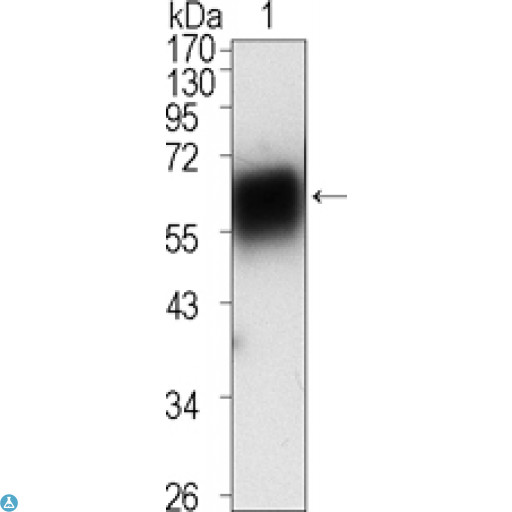 ROR1 Antibody - Western Blot (WB) analysis using ROR1 Monoclonal Antibody against extracellular domain of human ROR1 (aa30-423).