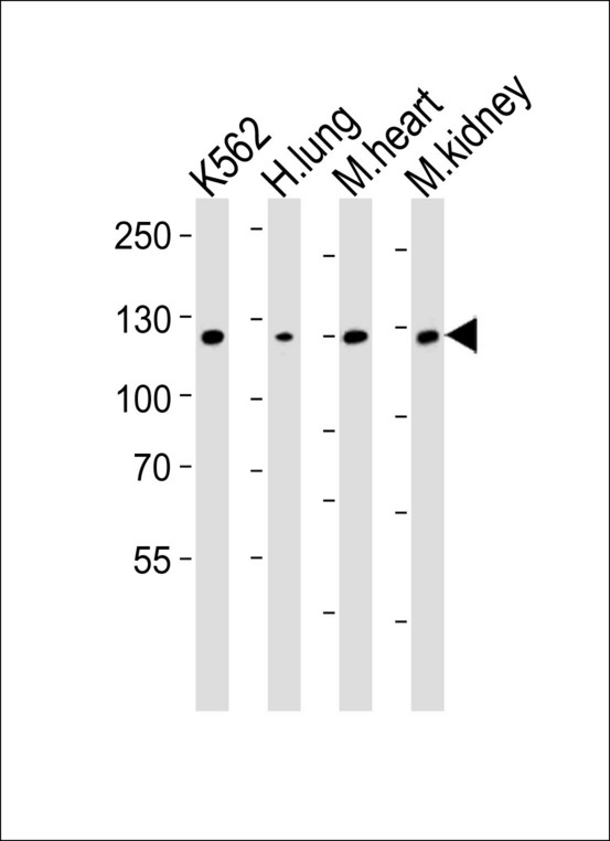 ROR1 Antibody - Western blot of lysates from K562 cell line, human lung, mouse heart and kidney tissue lysate(from left to right), using ROR1 Antibody. Antibody was diluted at 1:1000 at each lane. A goat anti-rabbit IgG H&L (HRP) at 1:10000 dilution was used as the secondary antibody. Lysates at 35ug per lane.