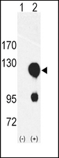 ROR2 Antibody - Western blot of ROR2 (arrow) using rabbit polyclonal ROR2 Antibody. 293 cell lysates (2 ug/lane) either nontransfected (Lane 1) or transiently transfected with the ROR2 gene (Lane 2) (Origene Technologies).