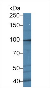 ROR2 Antibody - Western Blot; Sample: Human Hela cell lysate; Primary Ab: 1µg/ml Rabbit Anti-Human ROR2 Antibody Second Ab: 0.2µg/mL HRP-Linked Caprine Anti-Rabbit IgG Polyclonal Antibody