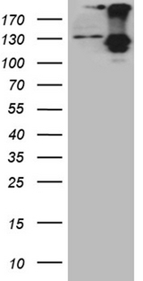 ROR2 Antibody - HEK293T cells were transfected with the pCMV6-ENTRY control. (Left lane) or pCMV6-ENTRY ROR2. (Right lane) cDNA for 48 hrs and lysed. Equivalent amounts of cell lysates. (5 ug per lane) were separated by SDS-PAGE and immunoblotted with anti-ROR2. (1:500)