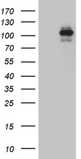 ROR2 Antibody - HEK293T cells were transfected with the pCMV6-ENTRY control. (Left lane) or pCMV6-ENTRY ROR2. (Right lane) cDNA for 48 hrs and lysed
