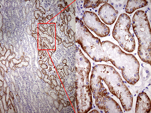 ROR2 Antibody - Immunohistochemical staining of paraffin-embedded Human Kidney tissue within the normal limits using anti-ROR2 mouse monoclonal antibody. (Heat-induced epitope retrieval by 1mM EDTA in 10mM Tris buffer. (pH8.5) at 120°C for 3 min. (1:250)