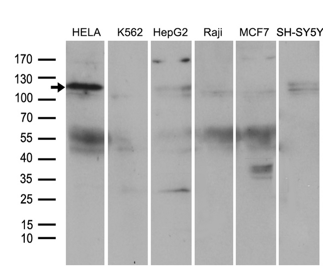 ROR2 Antibody - Western blot analysis of extracts. (35ug) from 6 different cell lines by using anti-ROR2 monoclonal antibody. (1:500)