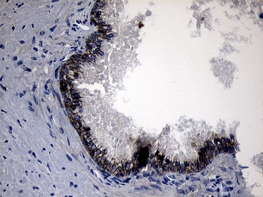 ROR2 Antibody - Immunohistochemical staining of paraffin-embedded Human prostate tissue within the normal limits using anti-ROR2 mouse monoclonal antibody. (Heat-induced epitope retrieval by 1mM EDTA in 10mM Tris buffer. (pH8.5) at 120°C for 3 min. (1:500)