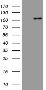 ROR2 Antibody - HEK293T cells were transfected with the pCMV6-ENTRY control. (Left lane) or pCMV6-ENTRY ROR2. (Right lane) cDNA for 48 hrs and lysed. Equivalent amounts of cell lysates. (5 ug per lane) were separated by SDS-PAGE and immunoblotted with anti-ROR2. (1:500)