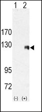 ROR2 Antibody - Western blot of ROR2 (arrow) using rabbit polyclonal ROR2 Antibody. 293 cell lysates (2 ug/lane) either nontransfected (Lane 1) or transiently transfected with the ROR2 gene (Lane 2) (Origene Technologies).