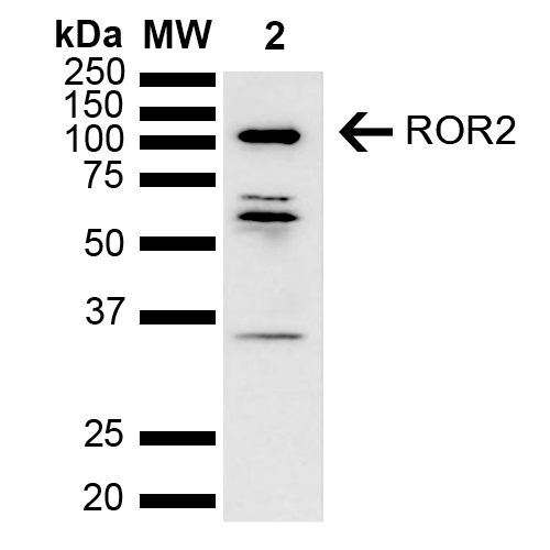 ROR2 Antibody - Western blot analysis of Human Cervical cancer cell line (HeLa) lysate showing detection of ~104.7 kDa ROR2 protein using Rabbit Anti-ROR2 Polyclonal Antibody. Lane 1: Molecular Weight Ladder (MW). Lane 2: Cervical Cancer cell line (HeLa) lysate. Load: 10 µg. Block: 5% Skim Milk in 1X TBST. Primary Antibody: Rabbit Anti-ROR2 Polyclonal Antibody  at 1:1000 for 2 hours at RT. Secondary Antibody: Goat Anti-Rabbit HRP:IgG at 1:4000 for 1 hour at RT. Color Development: ECL solution for 5 min at RT. Predicted/Observed Size: ~104.7 kDa. Other Band(s): ~60, 35 kDa degradation products.