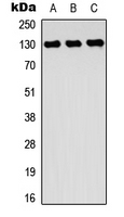 ROR2 Antibody - Western blot analysis of ROR2 expression in HeLa (A); Raji (B); MCF7 (C) whole cell lysates.
