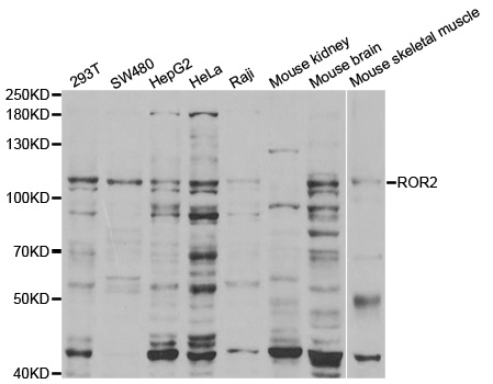 ROR2 Antibody - Western blot analysis of extracts of various cell lines, using ROR2 antibody.