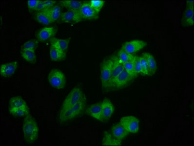 ROR2 Antibody - Immunofluorescence staining of HepG2 cells with ROR2 Antibody at 1:100, counter-stained with DAPI. The cells were fixed in 4% formaldehyde, permeabilized using 0.2% Triton X-100 and blocked in 10% normal Goat Serum. The cells were then incubated with the antibody overnight at 4°C. The secondary antibody was Alexa Fluor 488-congugated AffiniPure Goat Anti-Rabbit IgG(H+L).
