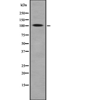 ROR2 Antibody - Western blot analysis of ROR2 using HeLa whole lysates.