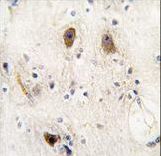 ROR2 Antibody - Formalin-fixed and paraffin-embedded human brain tissue reacted with ROR2 antibody, which was peroxidase-conjugated to the secondary antibody, followed by DAB staining. This data demonstrates the use of this antibody for immunohistochemistry; clinical relevance has not been evaluated.