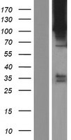 ROR2 Protein - Western validation with an anti-DDK antibody * L: Control HEK293 lysate R: Over-expression lysate