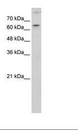 RORA / ROR Alpha Antibody - HepG2 Cell Lysate.  This image was taken for the unconjugated form of this product. Other forms have not been tested.