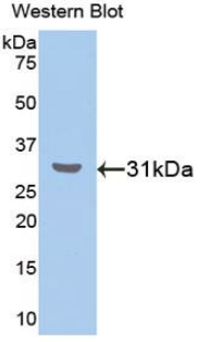RORA / ROR Alpha Antibody - Western blot of recombinant RORA / ROR Alpha.  This image was taken for the unconjugated form of this product. Other forms have not been tested.