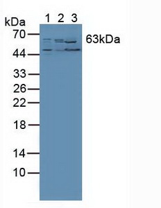 RORA / ROR Alpha Antibody - Western Blot; Sample: Lane1: Human PC-3 Cells; Lane2: Human Liver Tissue; Lane3: Mouse Kidney Tissue.