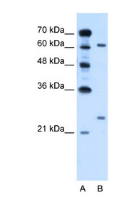 RORA / ROR Alpha Antibody - RORA antibody ARP45607_P050-NP_002934-RORA(RAR-related orphan receptor A) Antibody Western blot of HepG2 cell lysate.  This image was taken for the unconjugated form of this product. Other forms have not been tested.