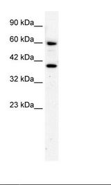 RORA / ROR Alpha Antibody - HepG2 Cell Lysate.  This image was taken for the unconjugated form of this product. Other forms have not been tested.