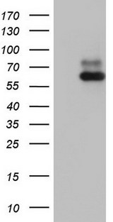 RORA / ROR Alpha Antibody - HEK293T cells were transfected with the pCMV6-ENTRY control (Left lane) or pCMV6-ENTRY RORA (Right lane) cDNA for 48 hrs and lysed. Equivalent amounts of cell lysates (5 ug per lane) were separated by SDS-PAGE and immunoblotted with anti-RORA.