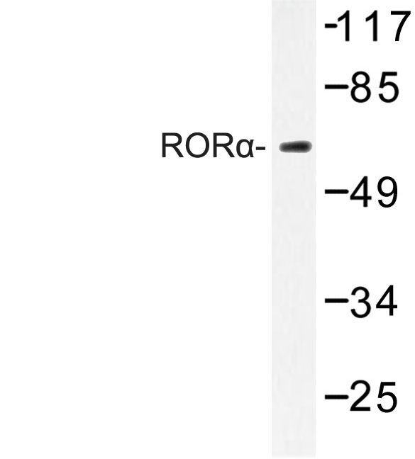 RORA / ROR Alpha Antibody - Western blot of ROR (G41) pAb in extracts from HeLa cells.