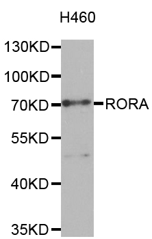 RORA / ROR Alpha Antibody - Western blot analysis of extracts of H460 cells.